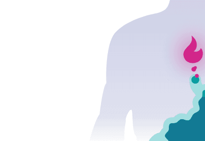 Heartburn and pregnancy